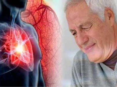 SERANGAN KOMPLIKASI JANTUNG SEMBUH SETELAH DI BALURKAN VARASH