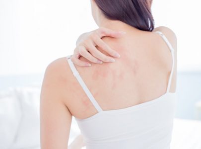 BIANG KERINGAT SEMBUH BERKAT SENTUHAN VARASH