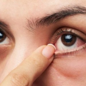 glukoma terbantu dengan varash obat herbal