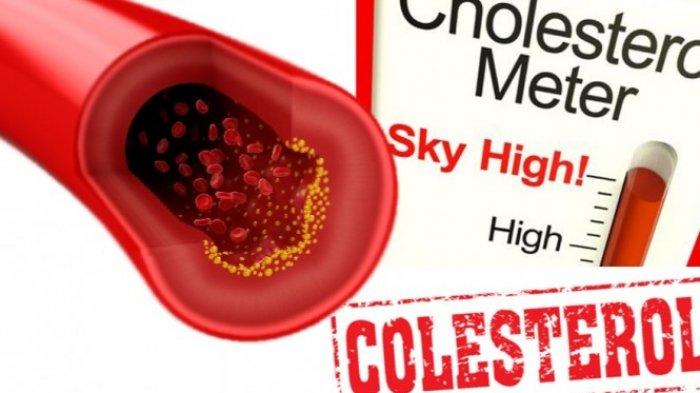 Hasil gambar untuk kolesterol