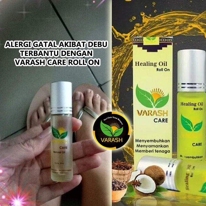 alergi gatal terbantu minyak varash care roll on