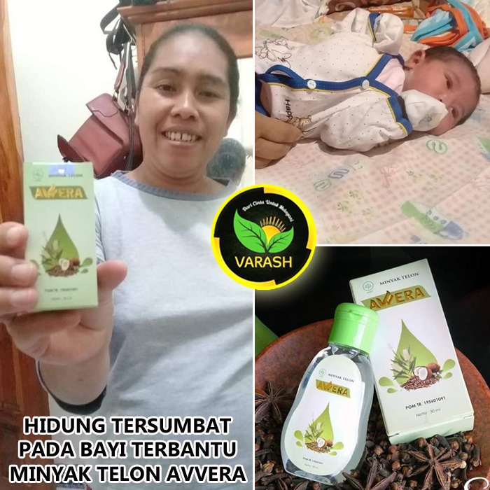 bayi hidung tersumbat diterapi minyak varash avvera oil