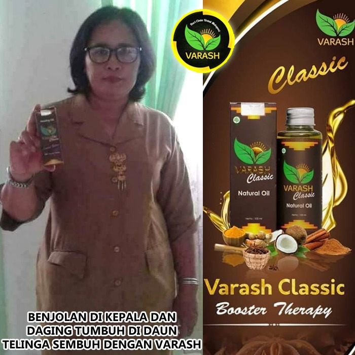 benjolan dikepala terbantu minyak varash natural classic oil