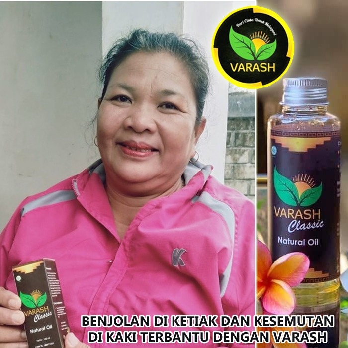 Benjolan di ketiak teratasi dengan varash