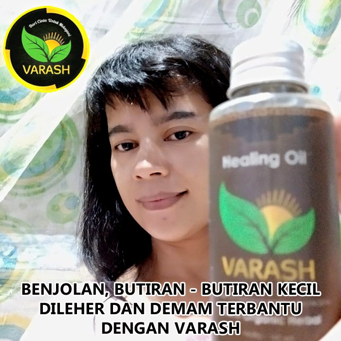 benjolan di leher terbantu minyak varash classic oil