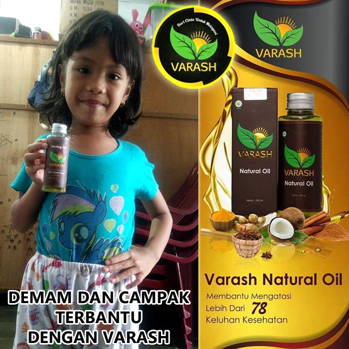 demam campak diterapi minyak varash classic oil