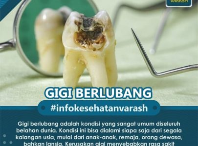 APA ITU GIGI BERLUBANG?
