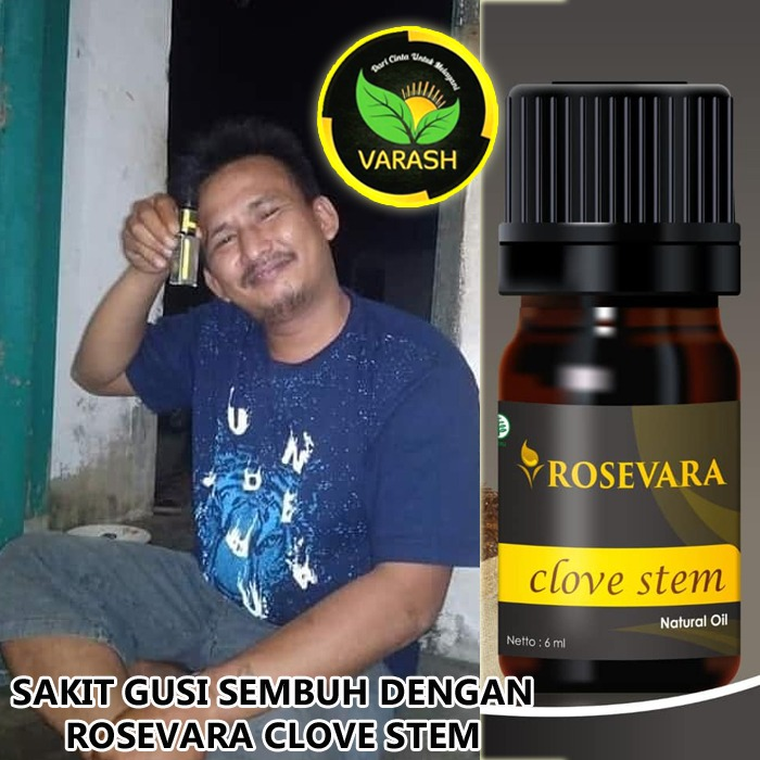sakit gusi terbantu dengan rosevara clove stem