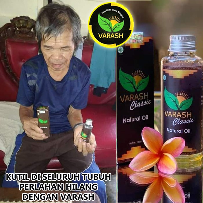 obat kutil diterapi minyak varash classic oil