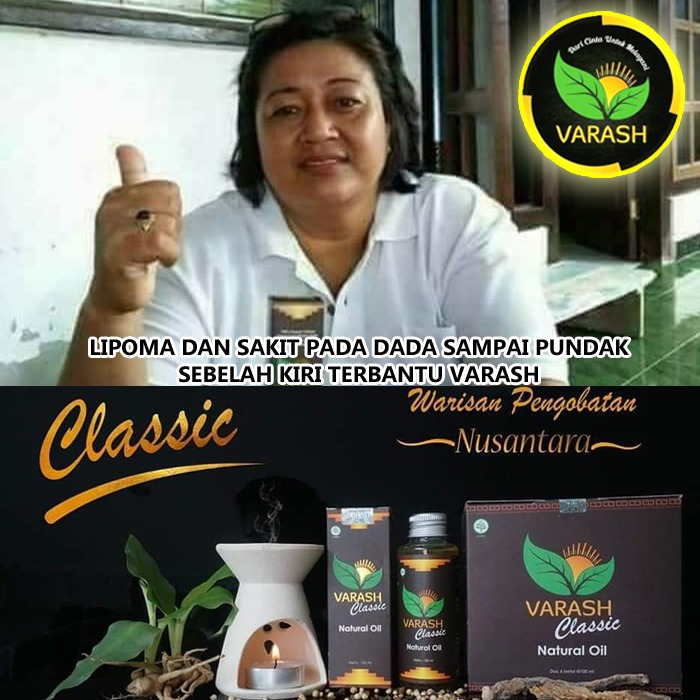 lipoma terbantu minyak varash natural classic oil