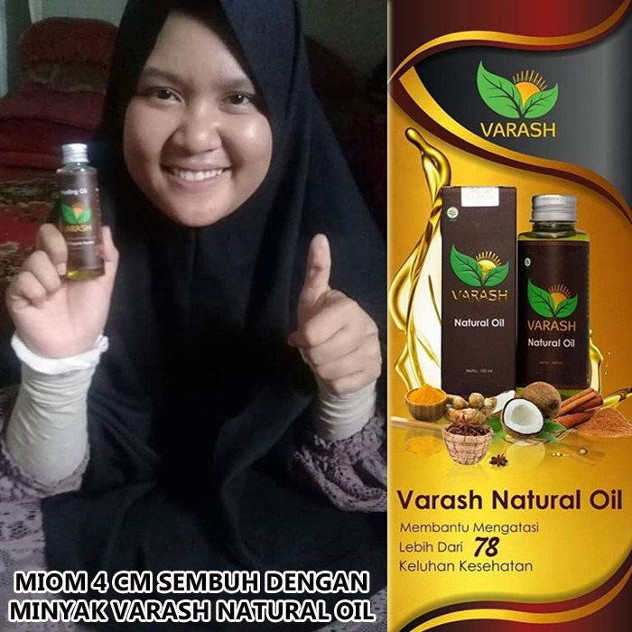 miom diterapi dengan minyak varash classic oil