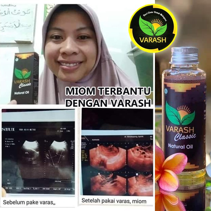 terapi miom dengan varash