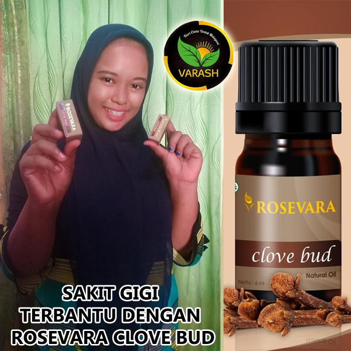 sakit gigi terbantu rosevara clove bud