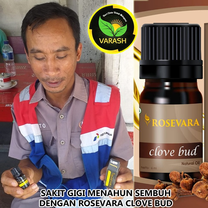 sakit gigi menahun dengan rosevara clovebud
