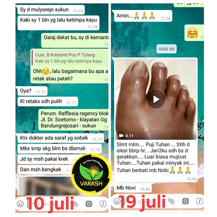 syaraf kaki sobek terbantu dengan minyak varash natural classic oil