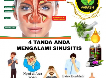 WASPADA 4 TANDA ANDA MENGALAMI SINUSITIS!!