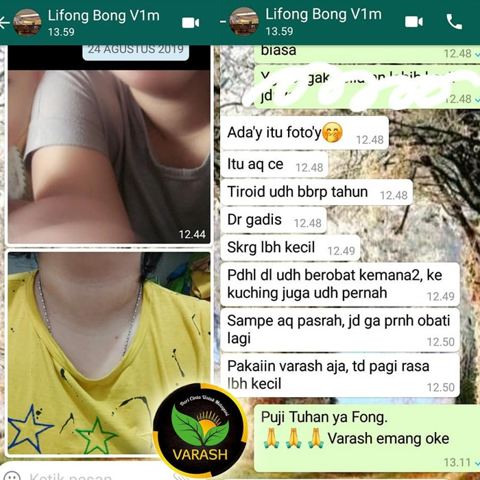 kelenjar tiroid terbantu dengan minyak varash classic oil