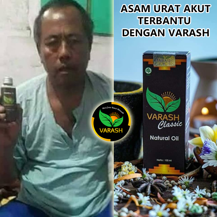 asam urat akut terbantu varash natural classic oil