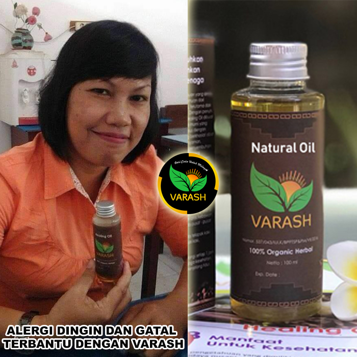 alergi dingin terbantu varash natural classic oil