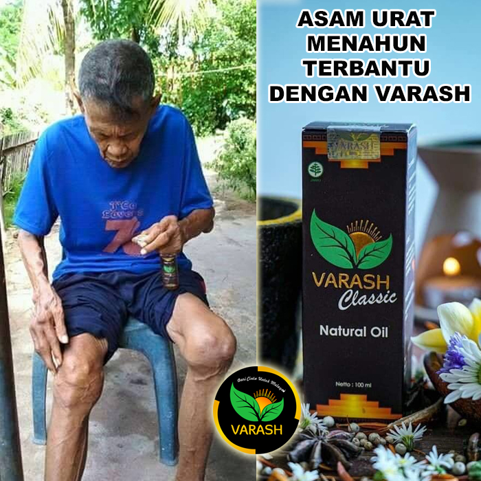 asam urat menahun terbantu varash natural classic oil