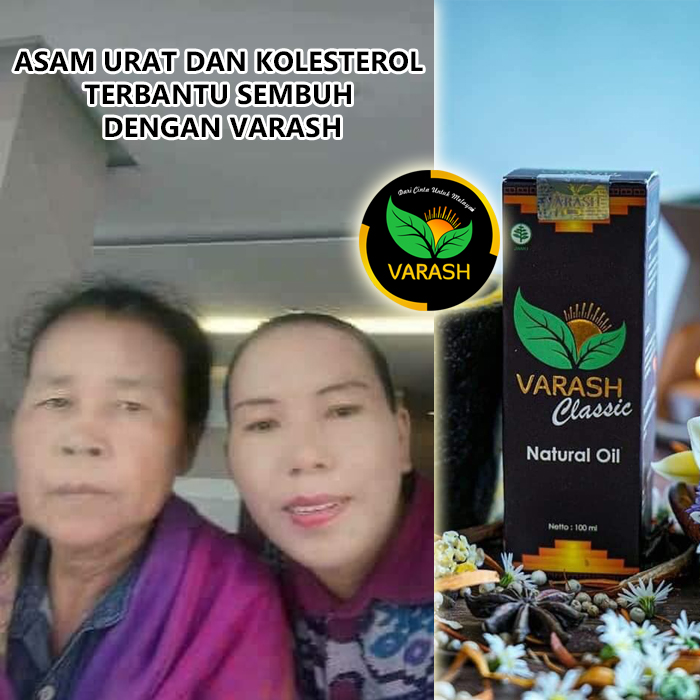 asam urat dan kolesterol terbantu varash natural classic oil