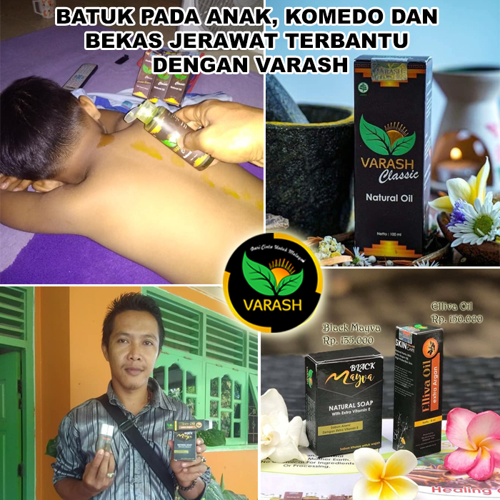 batuk komedo bekas jerawat terbantu varash natural classic oil