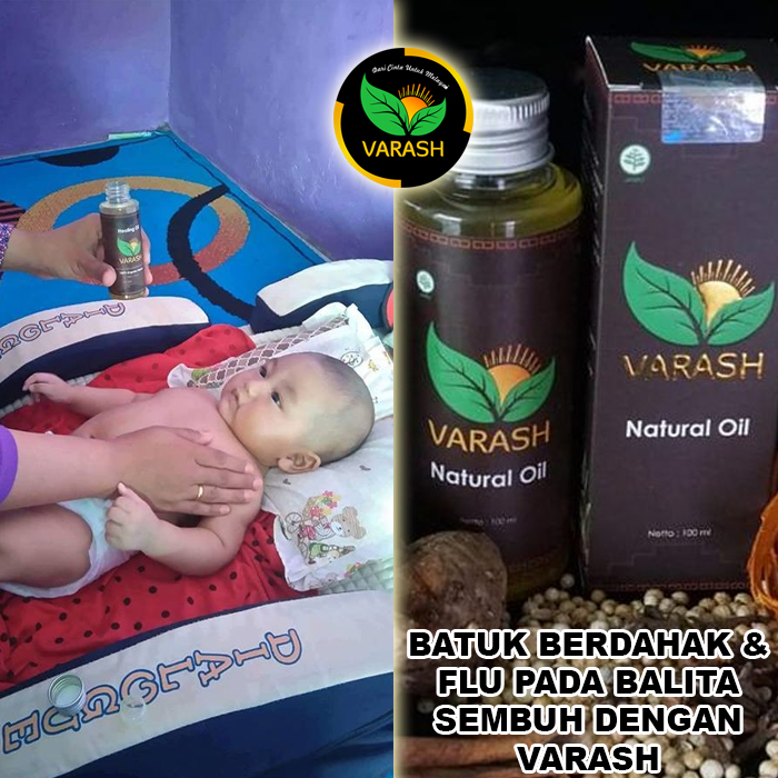batuk berdahak flu balita terbantu varash natural oil