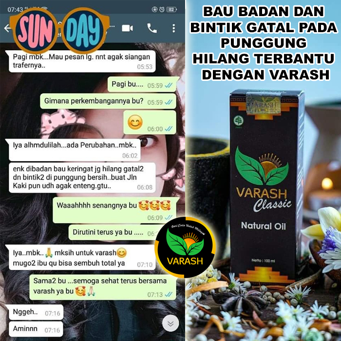 bau badan bintik gatal terbantu varash natural classic oil