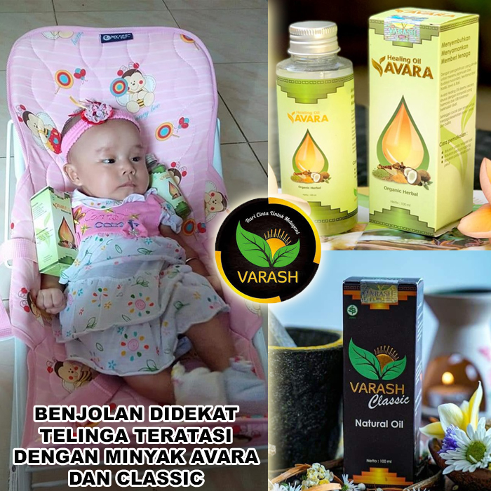 benjolan telinga terbantu varash natural avara oil