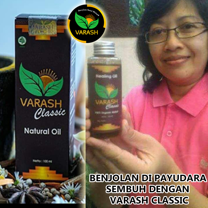 benjolan di payudara terbantu varash natural classic oil
