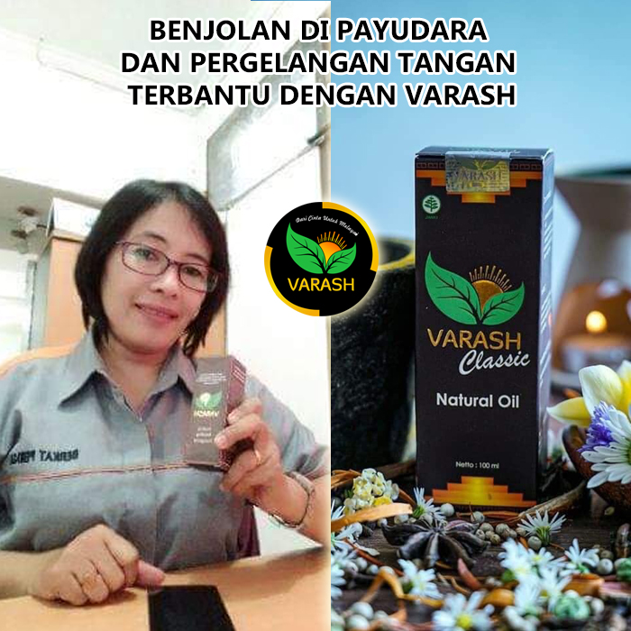 benjolan payudara varash natural classic oil