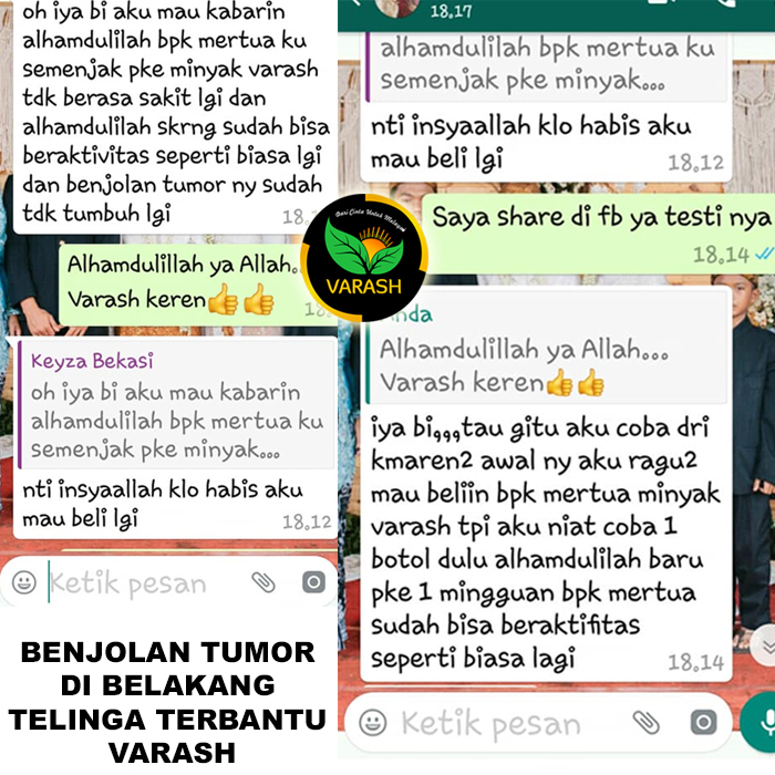tumor terbantu varash natural classic oil