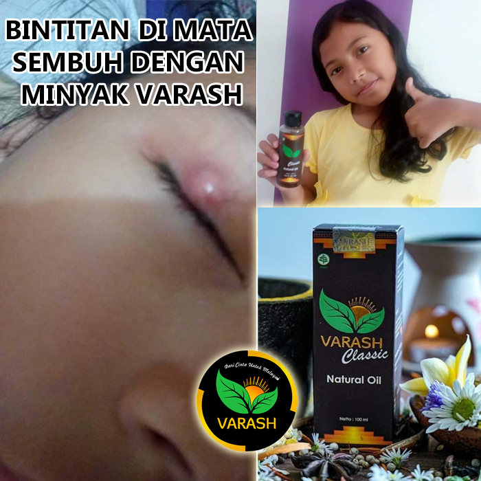 bintitan terbantu varash natural classic oil