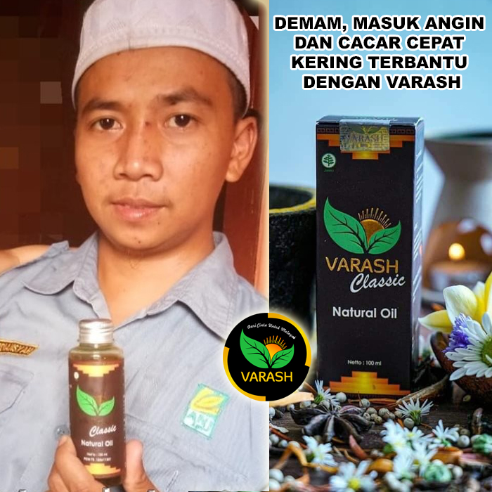 bau badan bintik gatal terbantu varash natural classic oil
