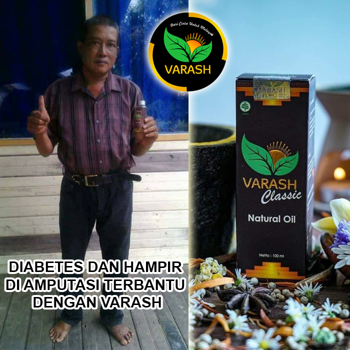 diabetes terbantu varash natural classic oil