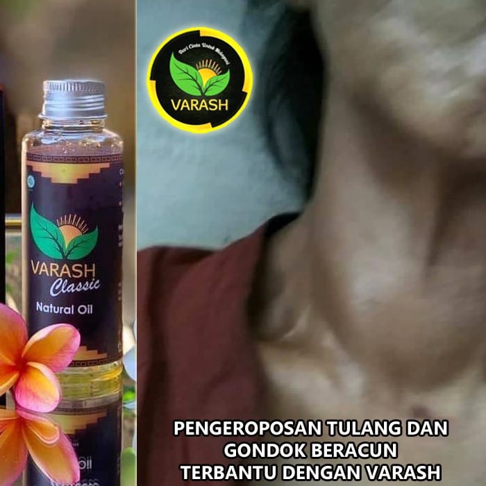 gondok beracun terbantu varash natural classic oil