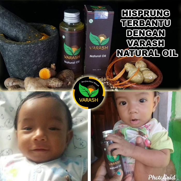hisprung terbantu varash natural classic oil