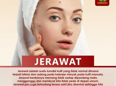 Cara Menghilangkan Jerawat
