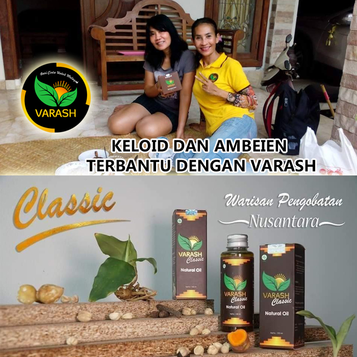 keloid dan ambeien varash natural classic oil