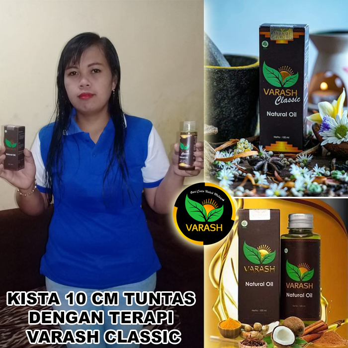 kista terbantu varash natural classic oil