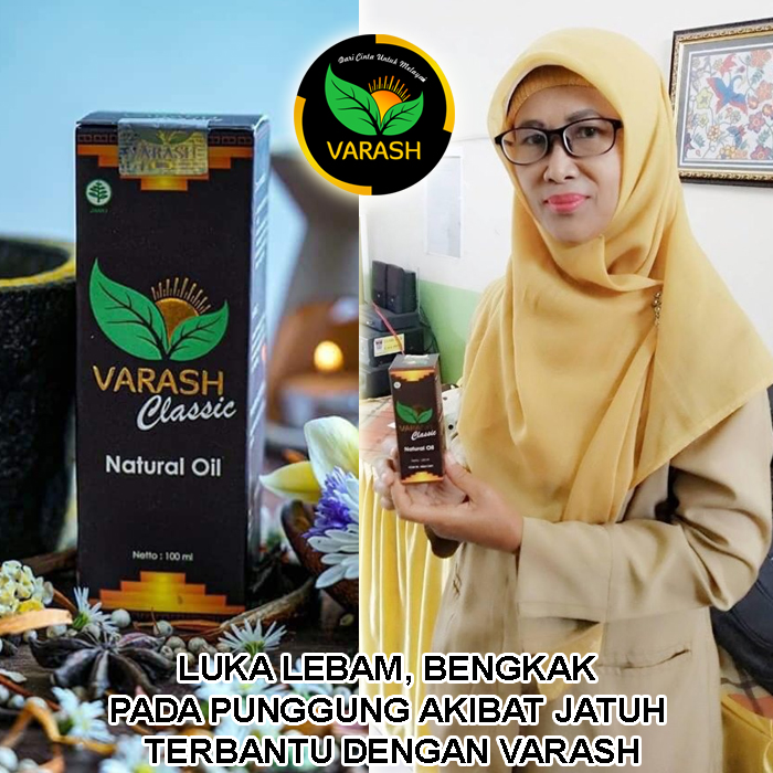 lebam terbantu varash natural classic oil