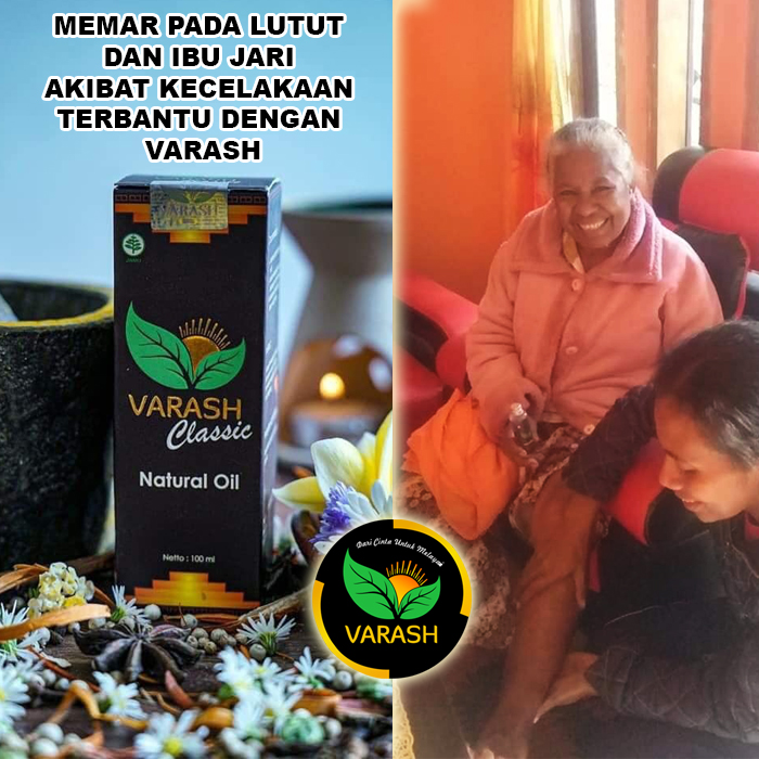 memar pada lutut terbantu varash natural classic oil
