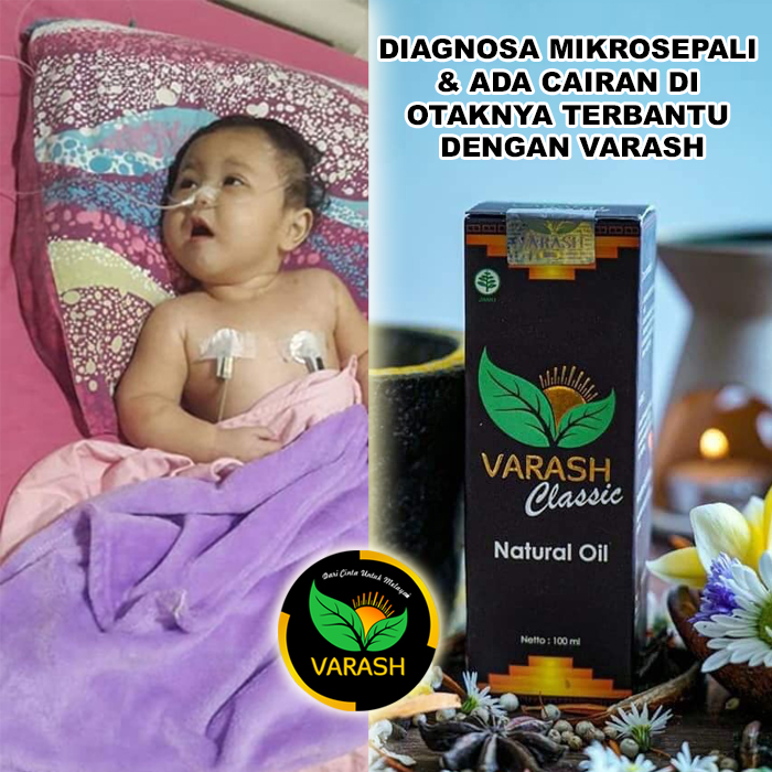 mikro sepali terbantu varash natural classic oil