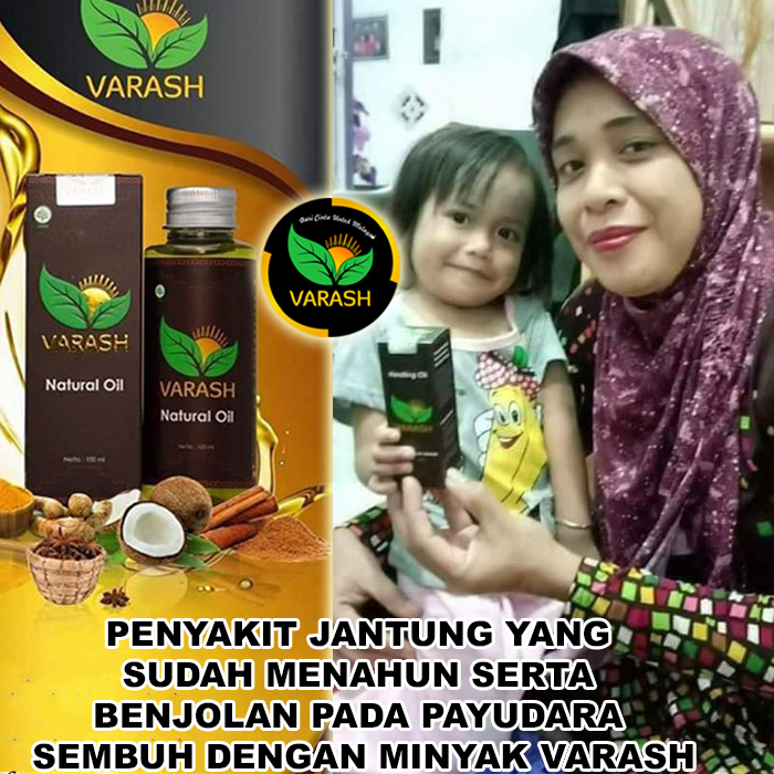bau badan bintik gatal terbantu varash natural classic oil