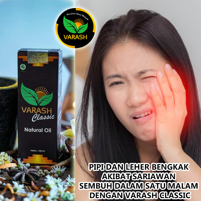 bengkak sariawan terapi varash natural classic oil