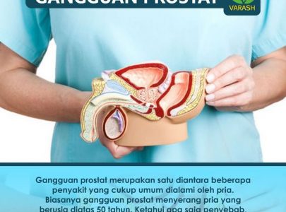 Gangguan Prostat