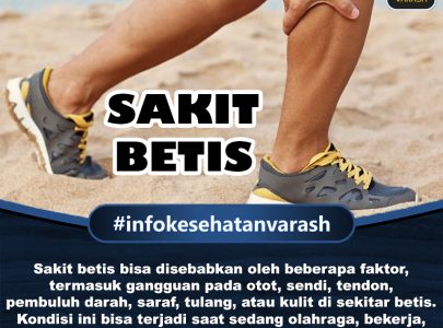 Cara Mengatasi Sakit Betis