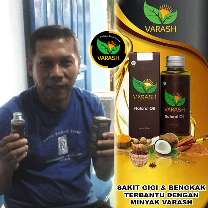 sakit gigi bengkak terbantu varash natural oil