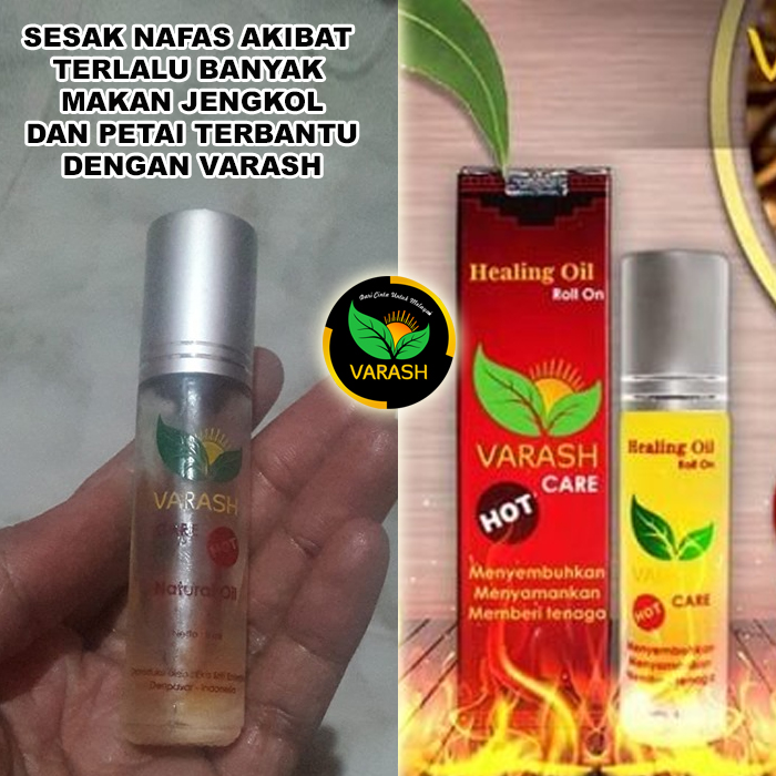 sesak nafas terbantu varash natural classic oil