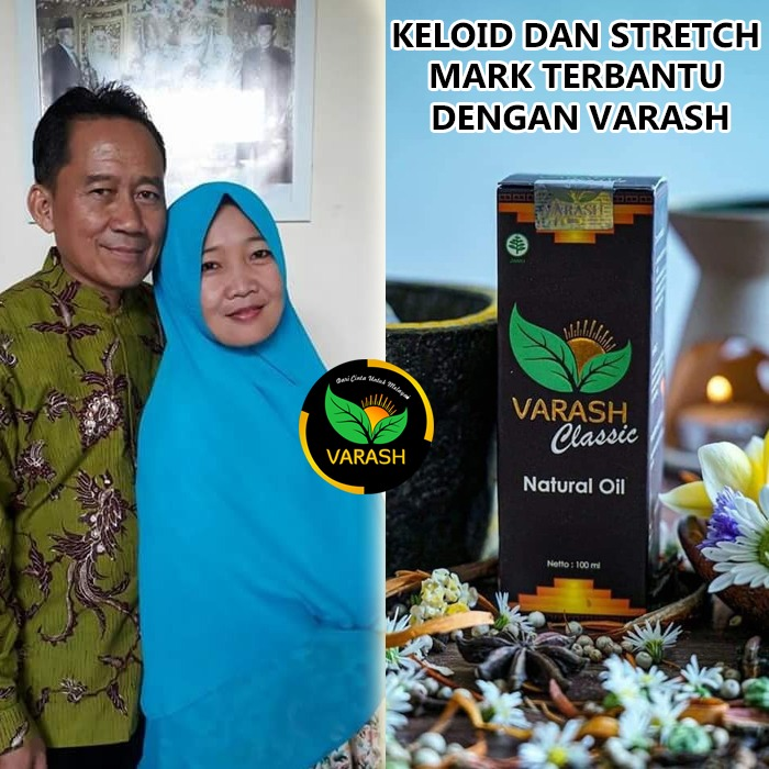 keloid dan stretch mark varash natural classic oil